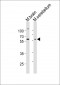 GLD2 Antibody (N-term)