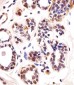 TBX1 Antibody (C-term)