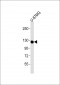 CSF1R Antibody