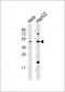 E2F2 Antibody (Center)