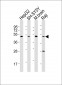 CTBP1 Antibody (C-term)
