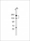 NOS2A Antibody (Center)