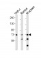 SYK Antibody