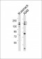 EGF Antibody (Center)