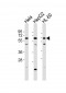 TBX5 Antibody (N-term)