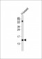 LALBA Antibody (Center)