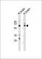 SOX11 Antibody (N-term)