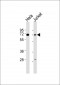 CBFA2T2 Antibody (N-term)