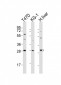 HAVCR2 Antibody (Center)