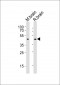 NPY2R Antibody (N-term)