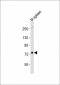 (Mouse) Melk Antibody (C-term)