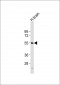 NPY5R Antibody (Center)