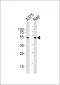 NFKBIE Antibody (Center)