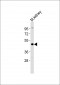 (Mouse) Ihh Antibody (N-term)