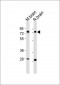 (Mouse) Nr4a2 Antibody (Center)