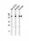 DPYSL5 Antibody (C-term)