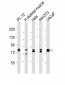 DNM1L Antibody (C-term)