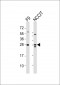 (Mouse) Lin28a Antibody (C-term)