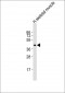 CDX4 Antibody (Center)