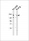 Mouse Erbb2 Antibody (P1236)