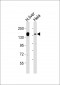 KDM6A Antibody (Center)