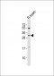 HAND1 Antibody (N-term)