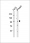 CLEC16A Antibody (C-term)