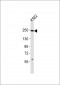 (Mouse) Smarca4 Antibody (C-term)