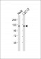 PTK7 Antibody (N-Term)