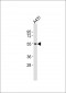 CNR1 Antibody (C-term)