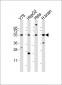 FOXN4 Antibody (C-term)