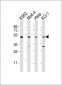 GATA2 Antibody (Center)