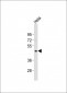 NODAL Antibody