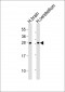 CNTF Antibody (C-term)