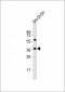 Nodal Antibody