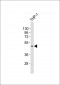 TACR1 Antibody (C-term)