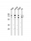 ASH2L Antibody (Center)