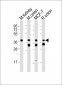 (Mouse) Epcam Antibody (C-term)