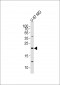 EREG Antibody (C-term)