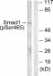 Smad1 (Phospho-Ser465) Antibody