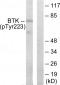 BTK (Phospho-Tyr223) Antibody