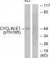 Cyclin E1 (Phospho-Thr395) Antibody