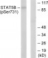 STAT5B (Phospho-Ser731) Antibody