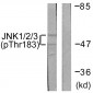 JNK1/2/3 (Phospho-Thr183+Tyr185) Antibody