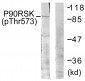 p90 RSK (Phospho-Thr573) Antibody