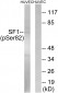 SF1 (Phospho-Ser82) Antibody
