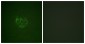 ACK1 (Phospho-Tyr284) Antibody