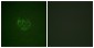 ACK1 (Phospho-Tyr284) Antibody