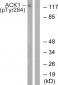 ACK1 (Phospho-Tyr284) Antibody