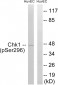 Chk1 (Phospho-Ser296) Antibody
